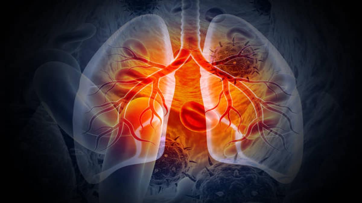 Lung Problems: Causes, Symptoms, Diagnosis