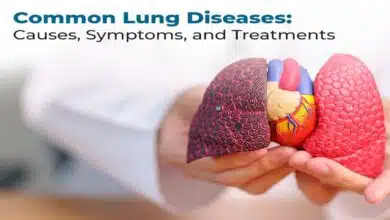 Lung Problems: Causes, Symptoms, Diagnosis