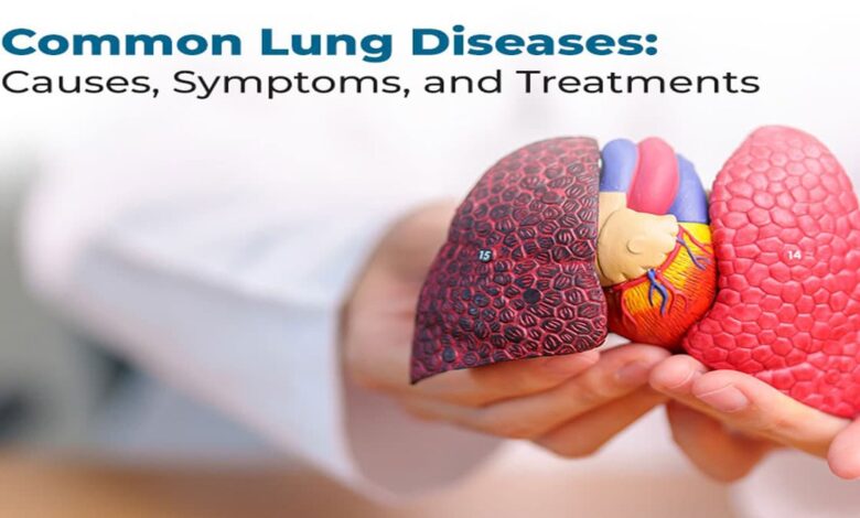 Lung Problems: Causes, Symptoms, Diagnosis