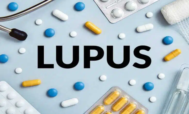 Lupus Disease: Causes, Symptoms, Treatment