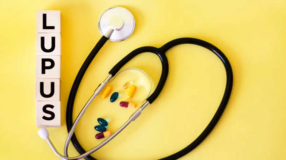 Lupus Disease4 Lupus Disease: Causes, Symptoms, Treatment