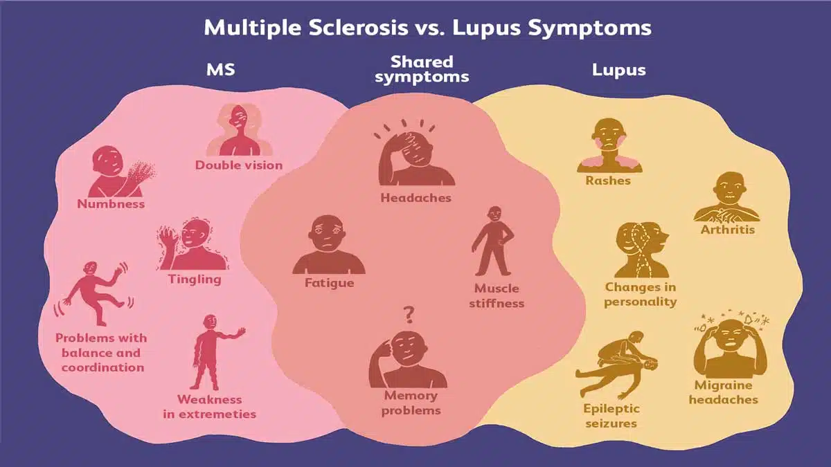 Multiple Sclerosis (MS): Causes, Symptoms