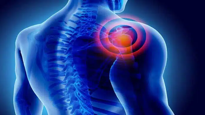 Muscle Diseases: Causes, Symptoms, Types