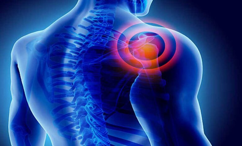 Muscle Diseases: Causes, Symptoms, Types