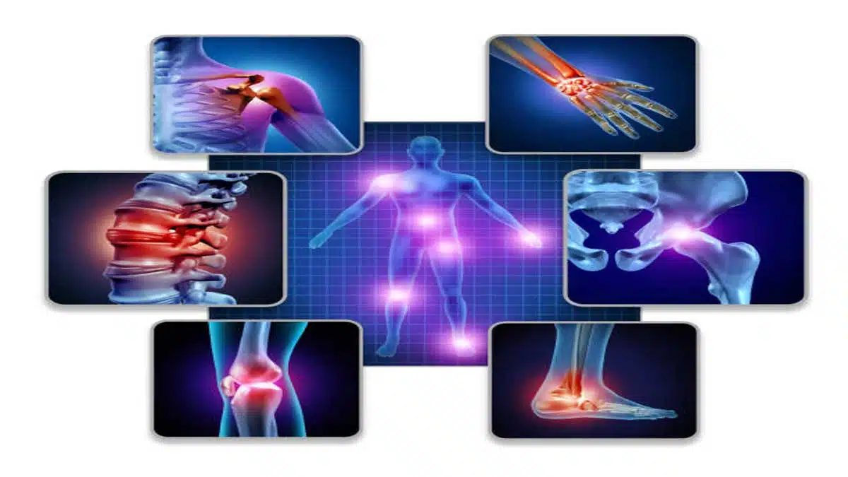 Muscle Diseases: Causes, Symptoms, Types