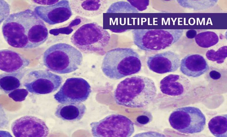 Myeloma (Multiple Myeloma) Disease