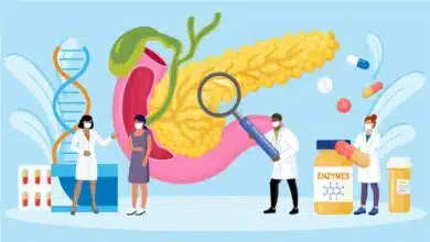 Pancreatic Disorders: Causes, Symptoms, Diagnosis