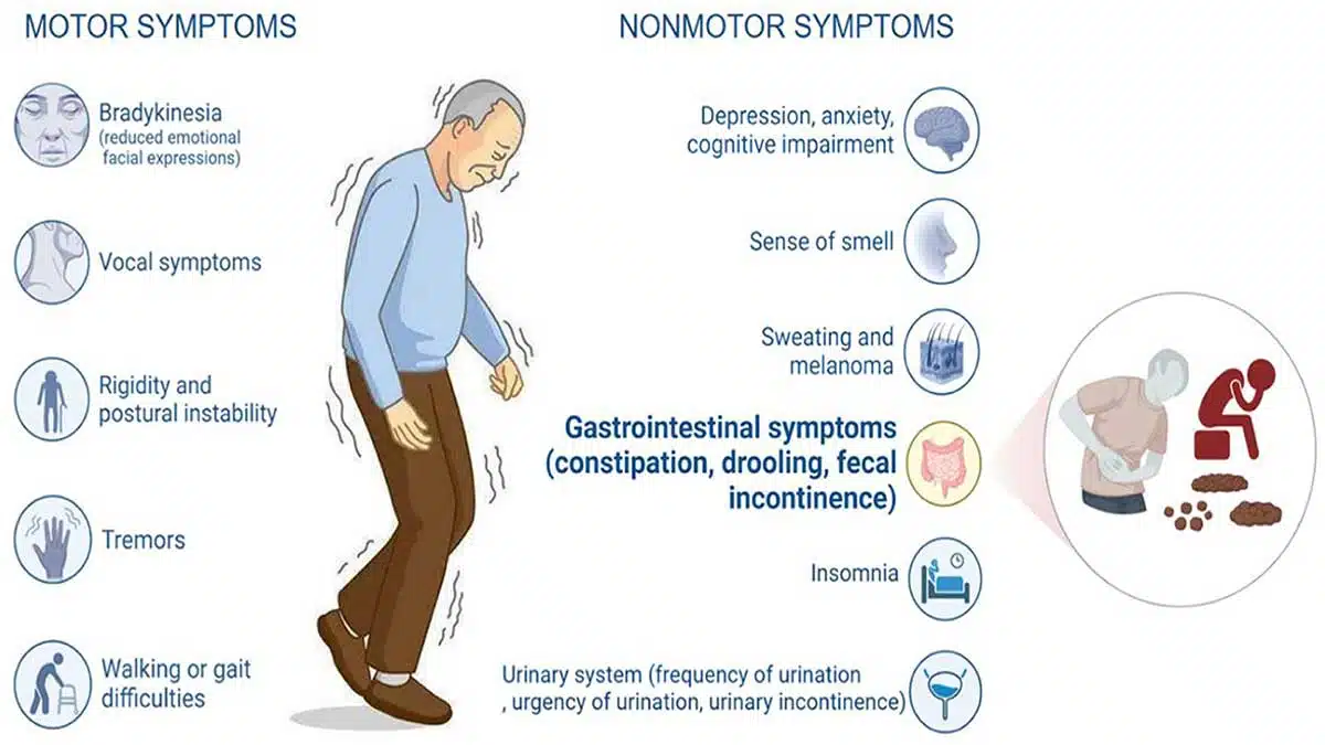 Parkinson's Disease: Symptoms, Causes