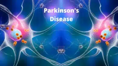 Parkinson's Disease: Symptoms, Causes