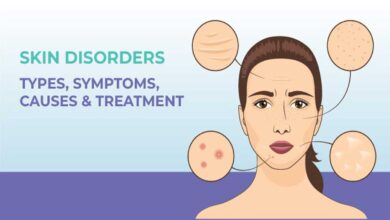 Skin Disorders: Types, Causes, Symptoms