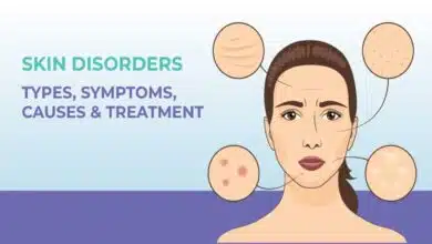 Skin Disorders: Types, Causes, Symptoms