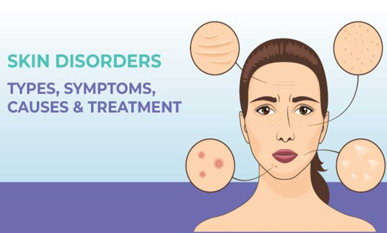 Skin Disorders: Types, Causes, Symptoms