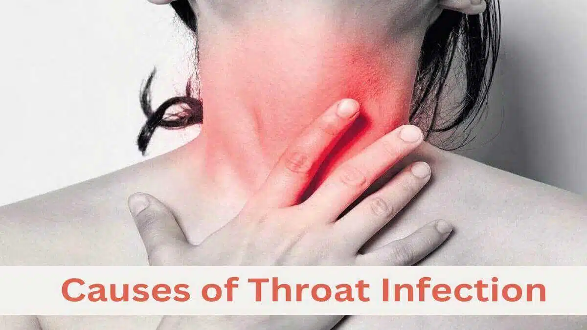 Throat Problems and Diseases: Causes