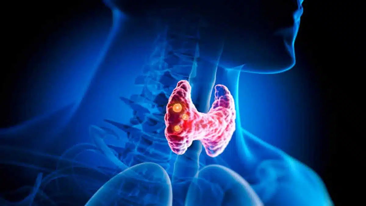 Throat Problems and Diseases: Causes