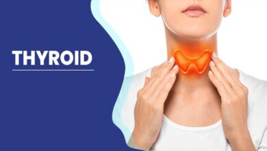Thyroid Disease: Causes, Symptoms, Treatment
