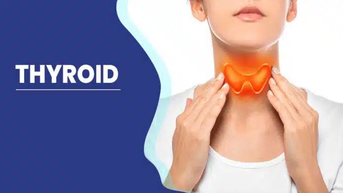 Thyroid Disease: Causes, Symptoms, Treatment
