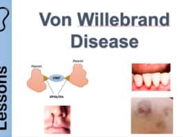 Von Willebrand Disease: Causes, Symptoms