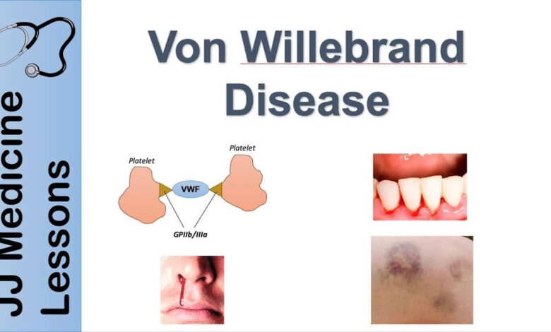 Von Willebrand Disease: Causes, Symptoms