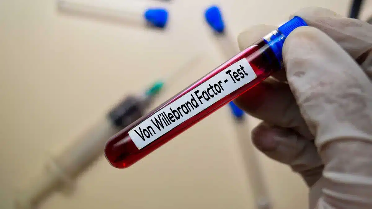 Von Willebrand Disease: Causes, Symptoms
