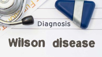 Wilson Disease: Complete Information, Causes