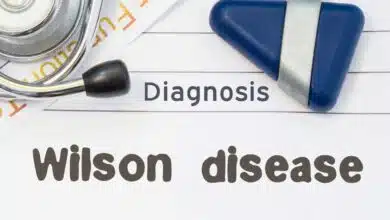 Wilson Disease: Complete Information, Causes