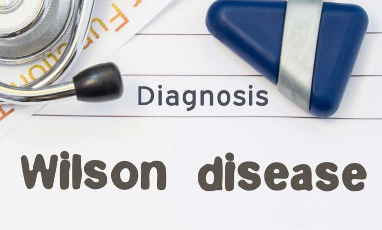 Wilson Disease: Complete Information, Causes