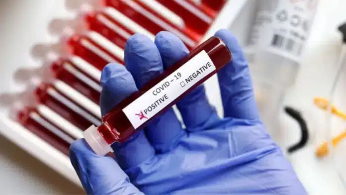 COVID-19: Amid rise in cases, Health Ministry issues advisory, urges people not to panic