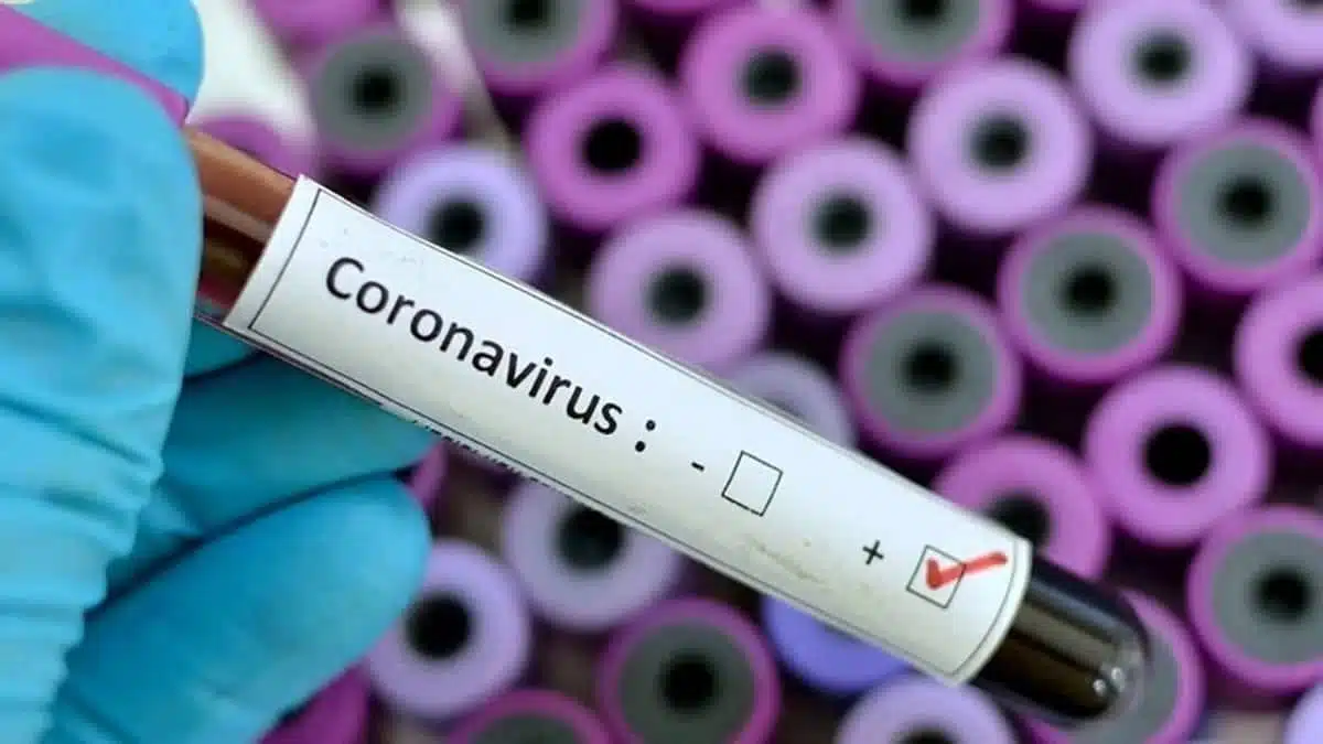 Delhi has 104 active Covid cases, 99 cases reported in a week