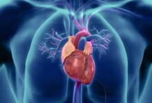 Heart Blockage: 7 Ayurvedic Remedies to Open Blocked Arteries Naturally
