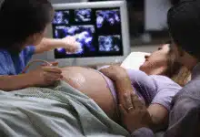 Miracle of AI: A woman who failed IVF 15 times became pregnant after 19 years