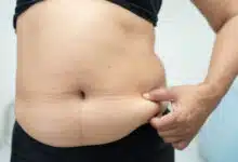 Be careful with belly fat, it can increase the risk of these 10 diseases