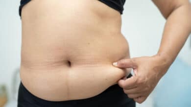 Be careful with belly fat, it can increase the risk of these 10 diseases