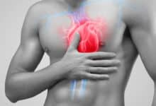 What is the connection between heart attack and stroke? Know the main symptoms