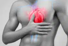 What is the connection between heart attack and stroke? Know the main symptoms