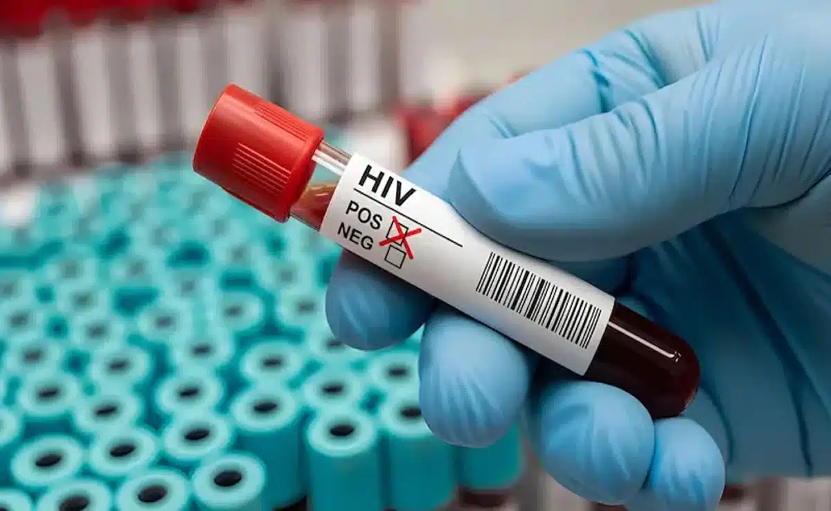 Suspected negligence at a hospital in MP: Four children with thalassemia test positive for HIV.
