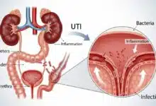 6 Key Symptoms and Signs of Urinary Tract Infections